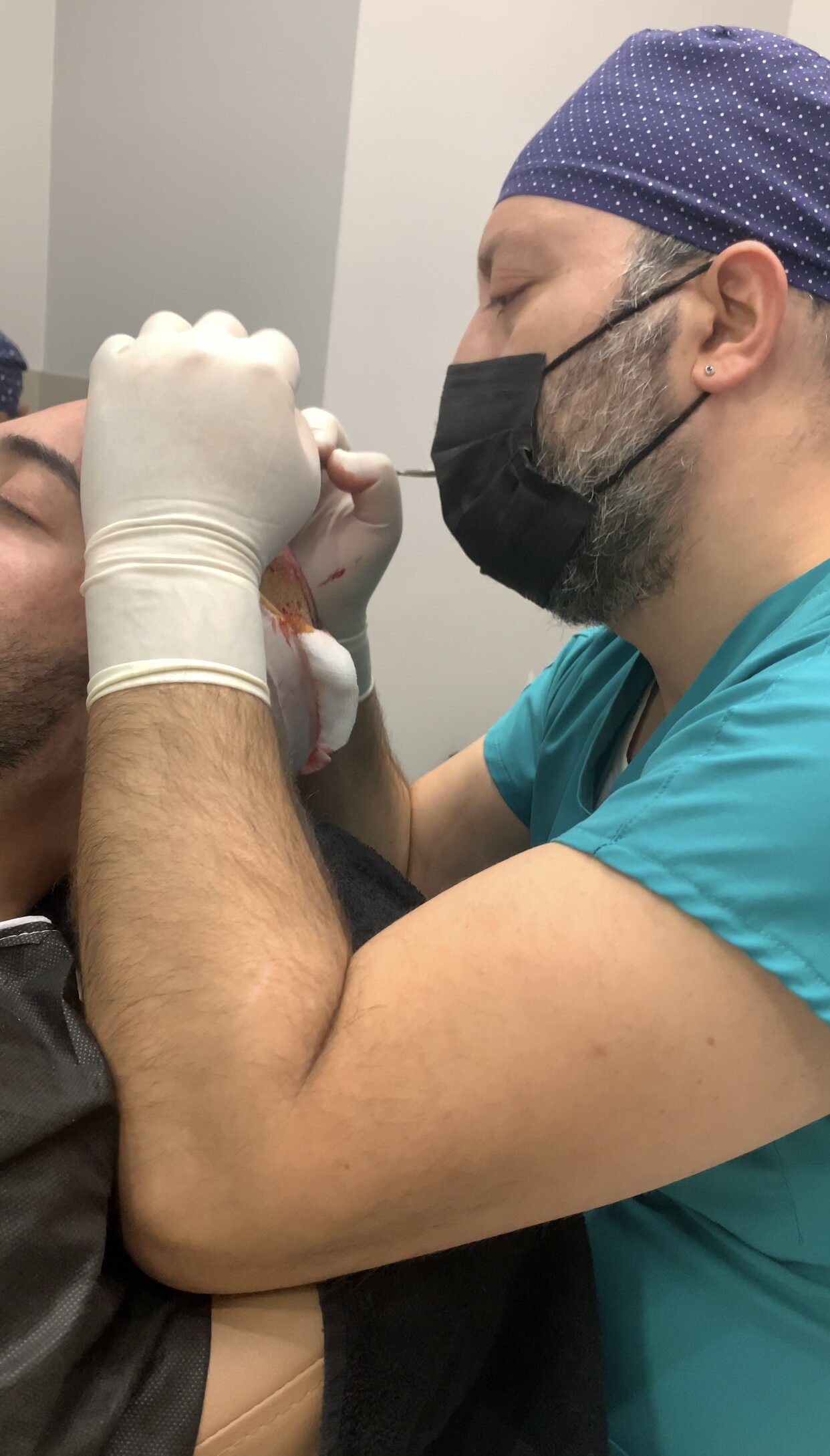 Kosten für Haarimplantate 15 Media Image8