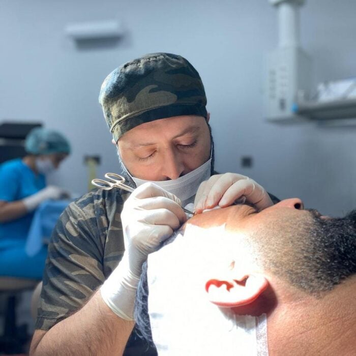 este surgery hair transplant surgery 2