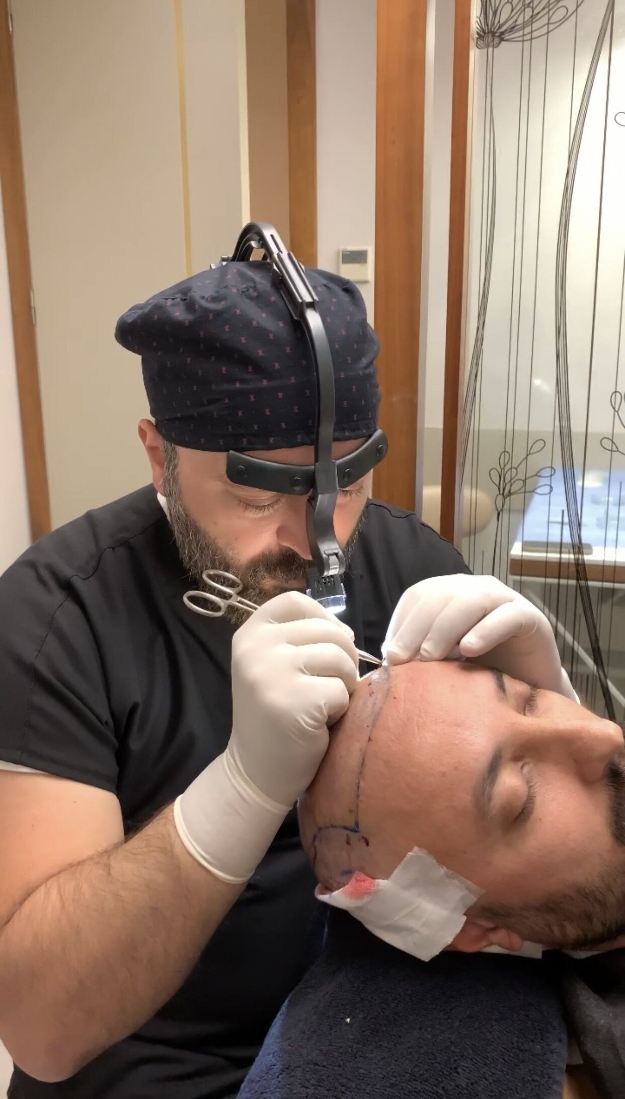 Kosten für Haarimplantate 9 Media Image5