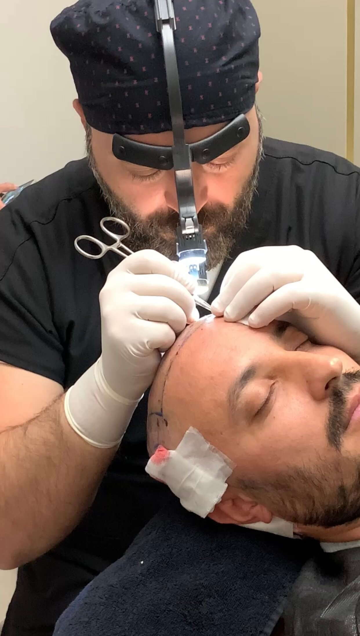Kosten für Haarimplantate 5 Media Image3