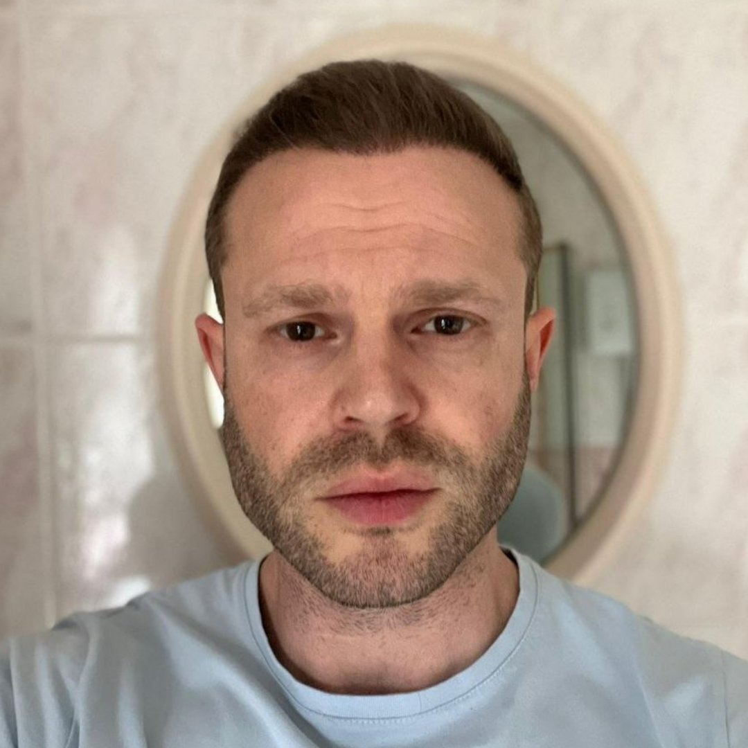 este surgery home before after 6