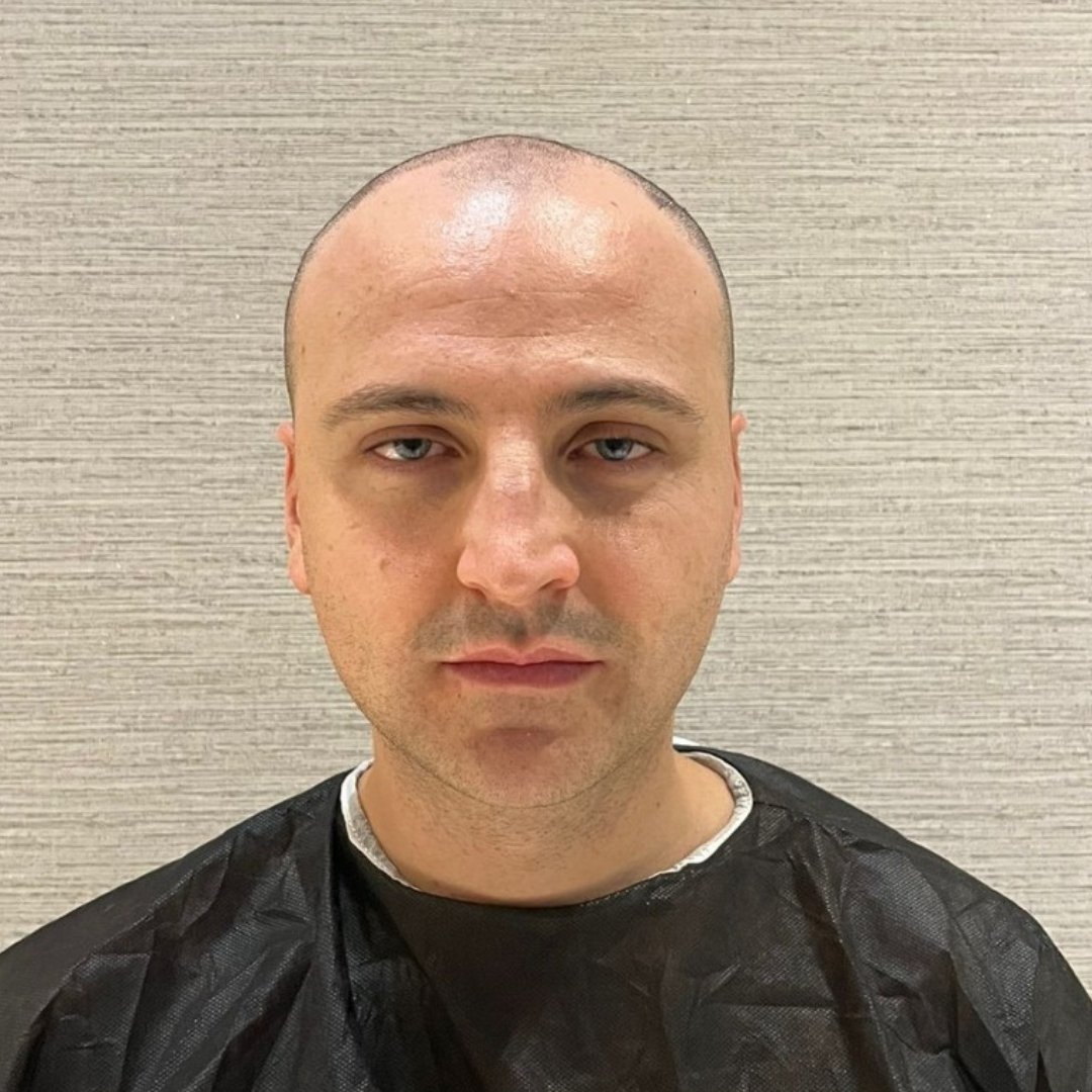 este-surgery-home-before-after-9