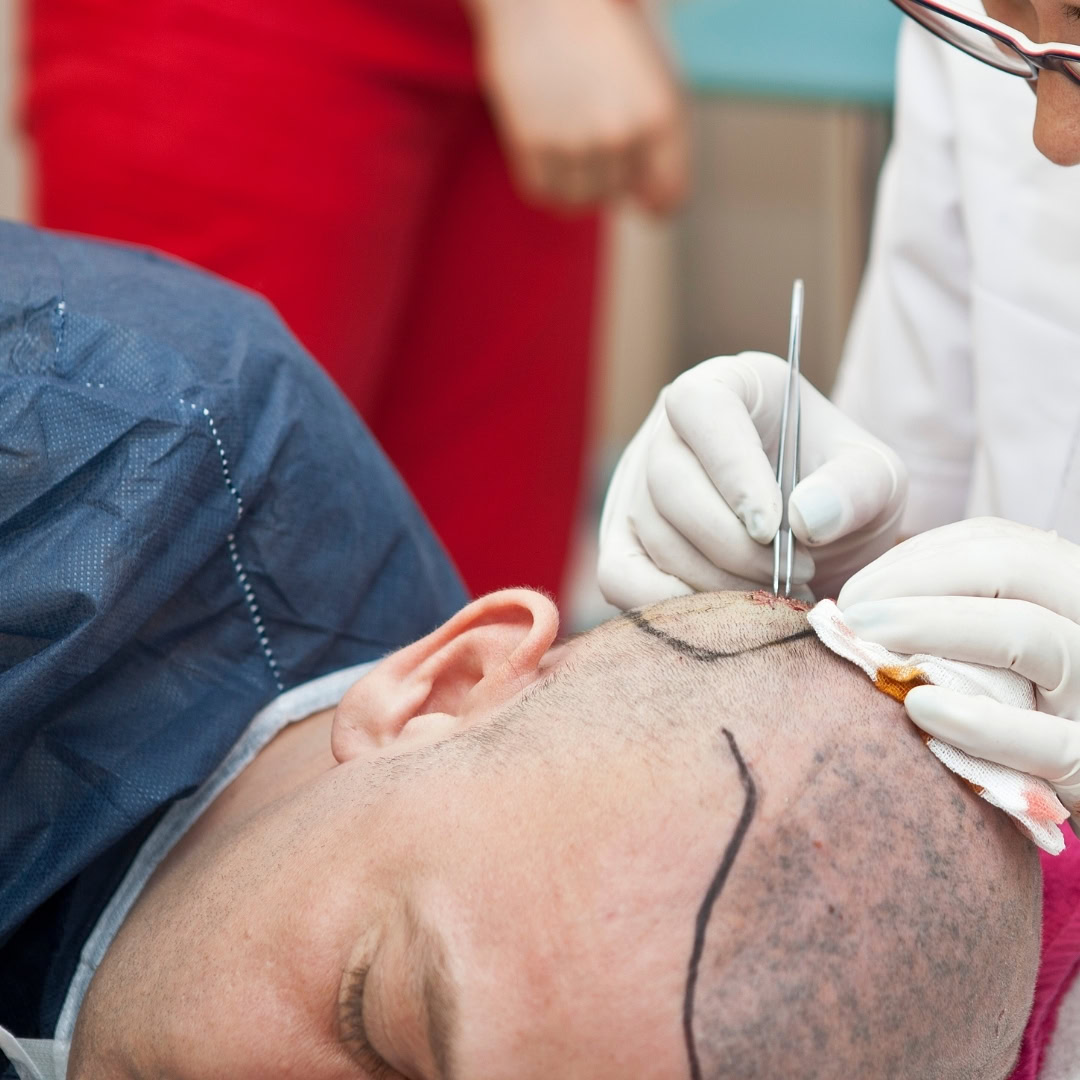 este surgery images 1