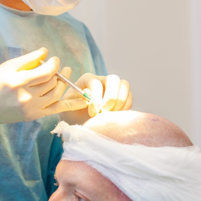 este surgery images 10