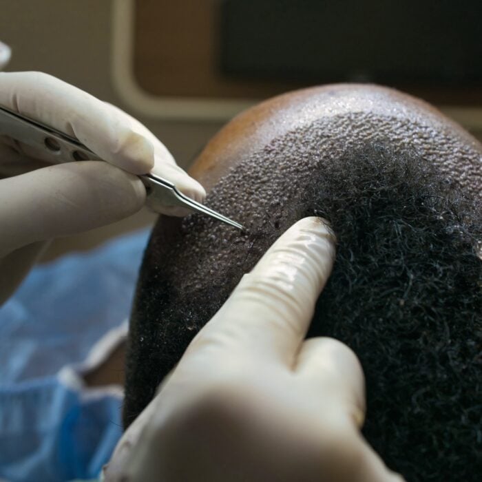 este surgery images 12