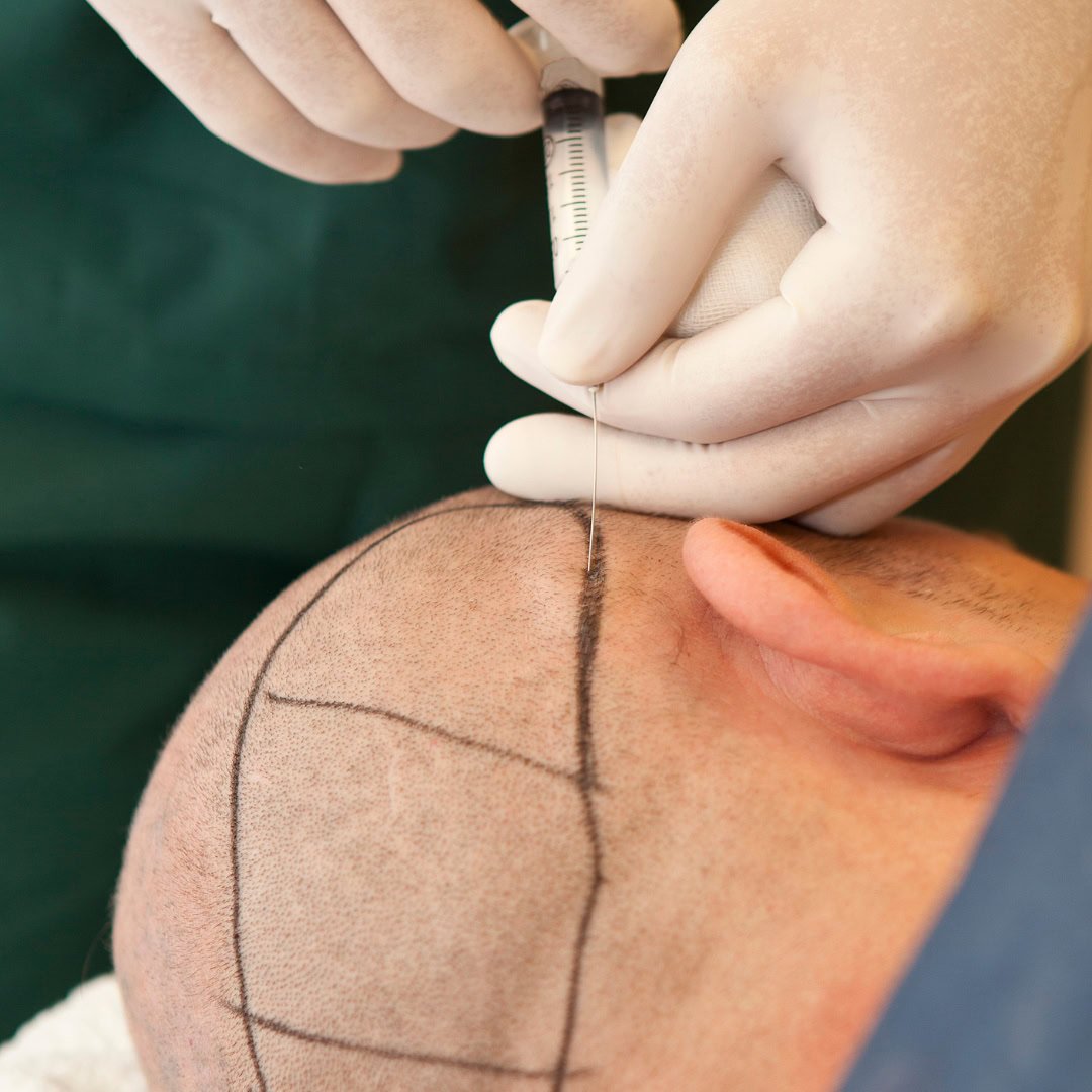este surgery images 13