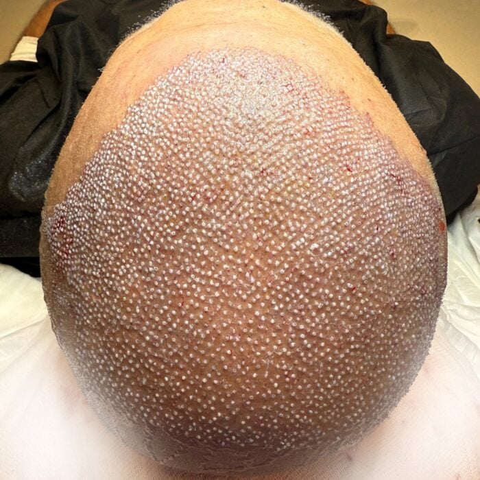 este surgery images 15