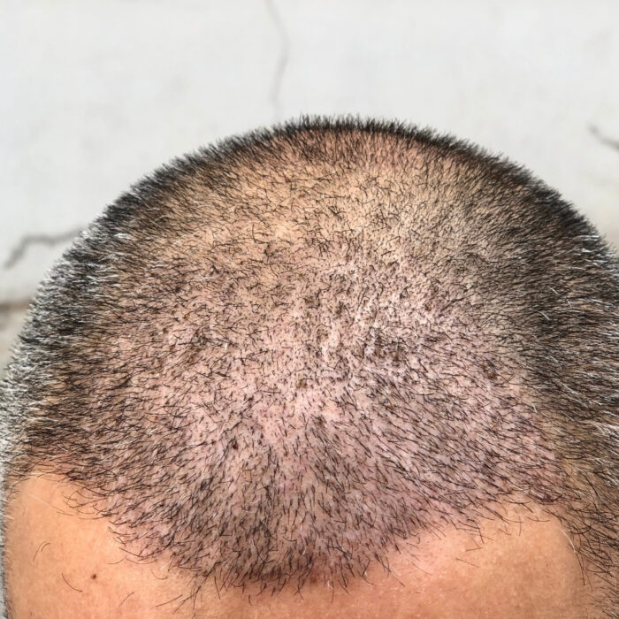 este surgery images 2