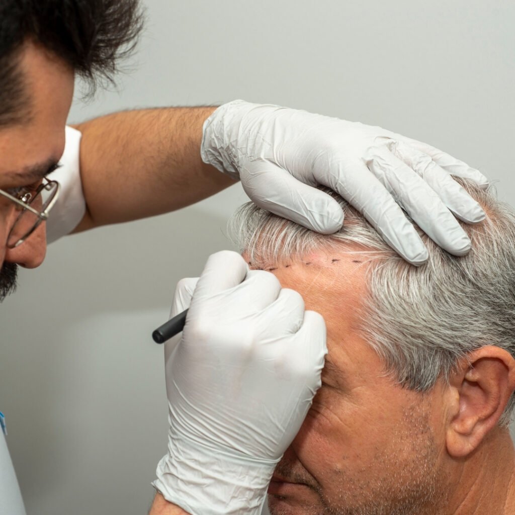 este surgery images 3