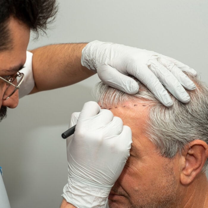 este surgery images 3