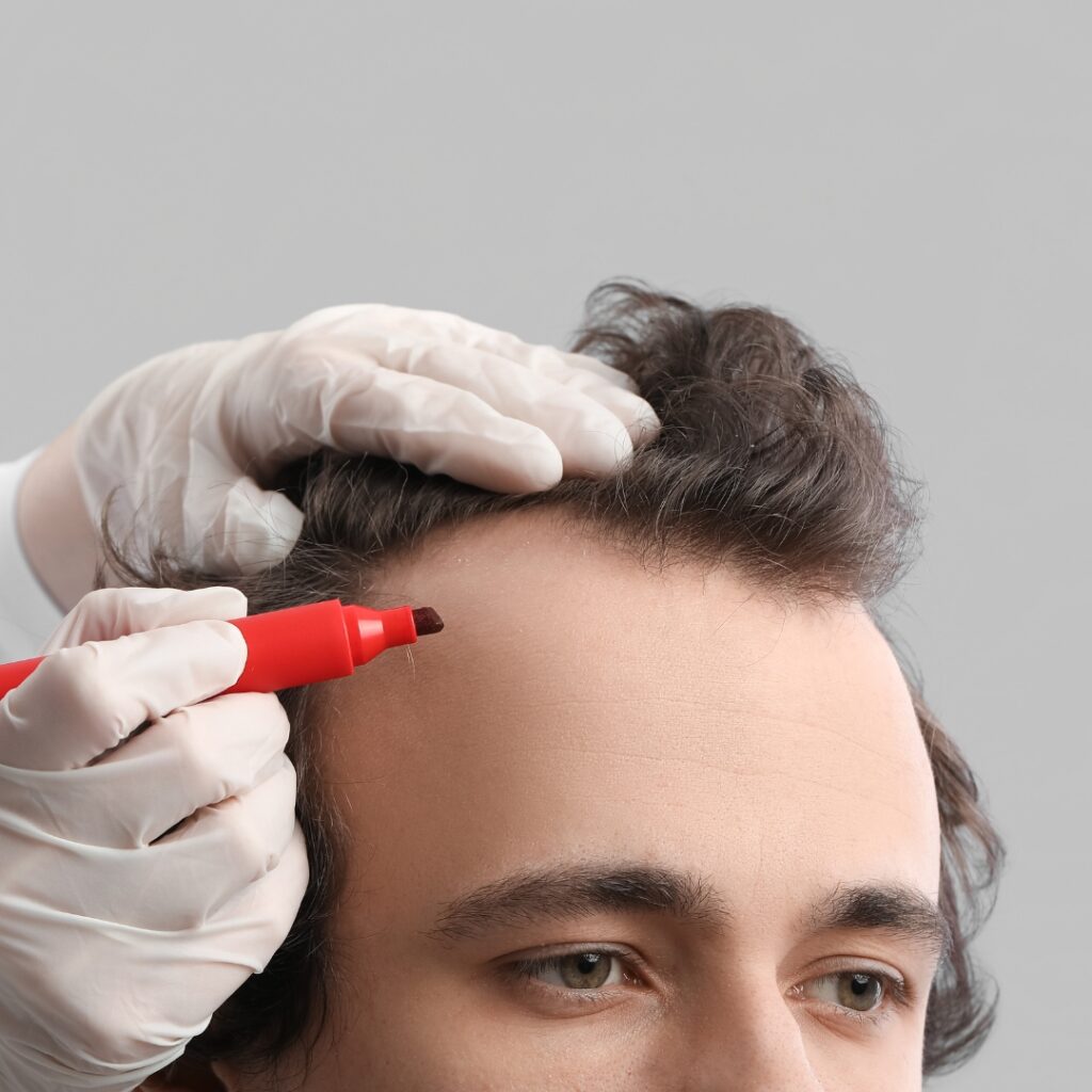 este surgery images 7