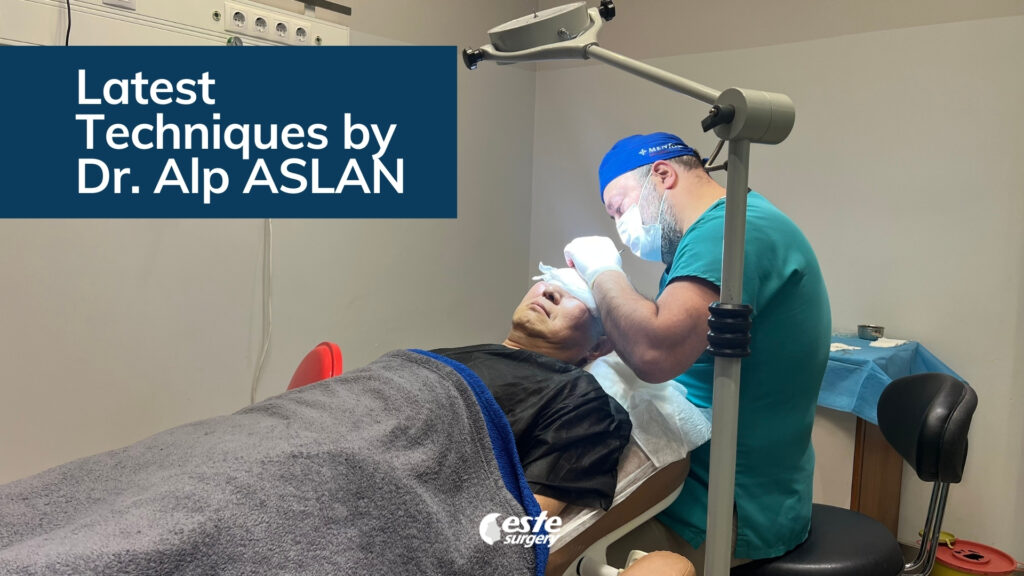 este surgery best hair transplant method 2026 2