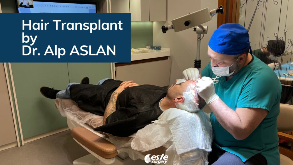 este surgery best hair transplant method 2026 4