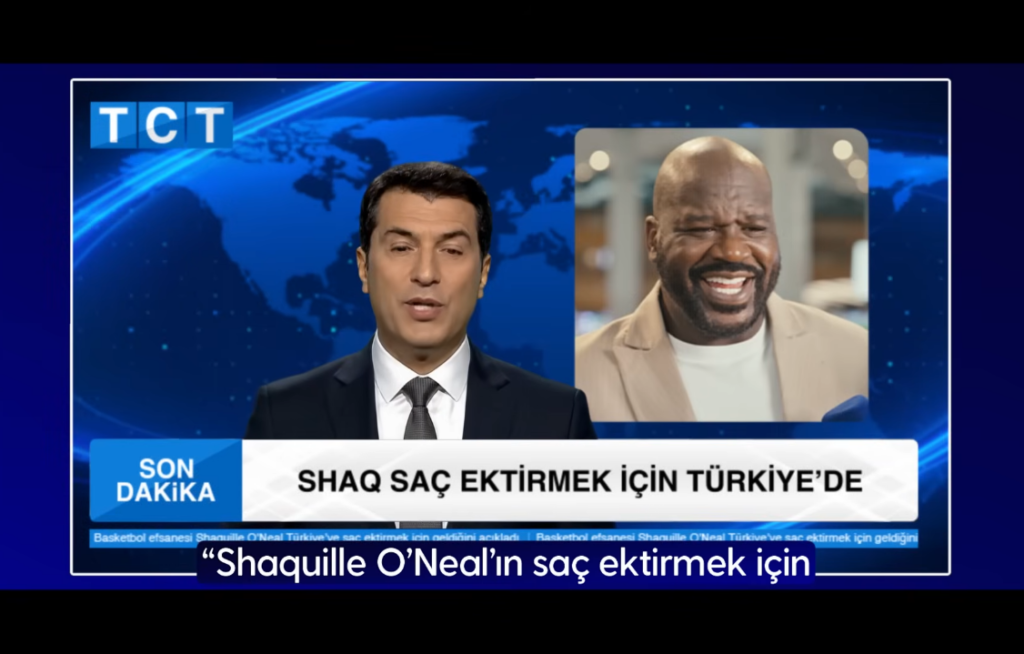 image 1 did Shaquille O’Neal have hair transplant in Turkey?
