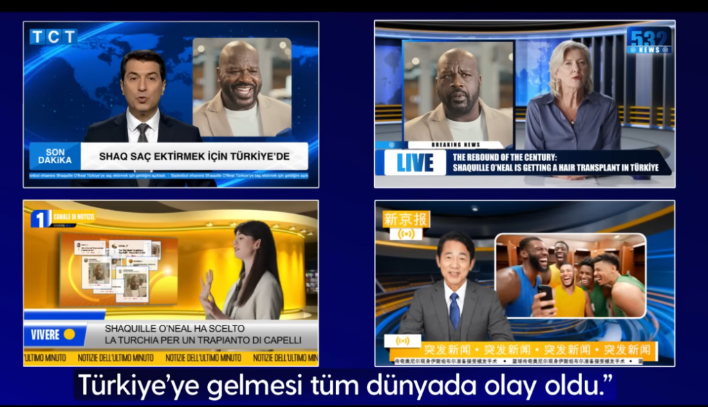 image 2 Shaquille O’Neal hair transplant gone viral